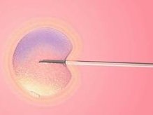 贵阳妇幼保健院试管婴儿费用大约多少？2026助孕成功率公布